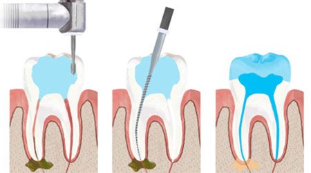 Dr. Adrian Pitila - cabinet stomatologic